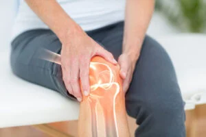 Radiation Therapy for Arthritis