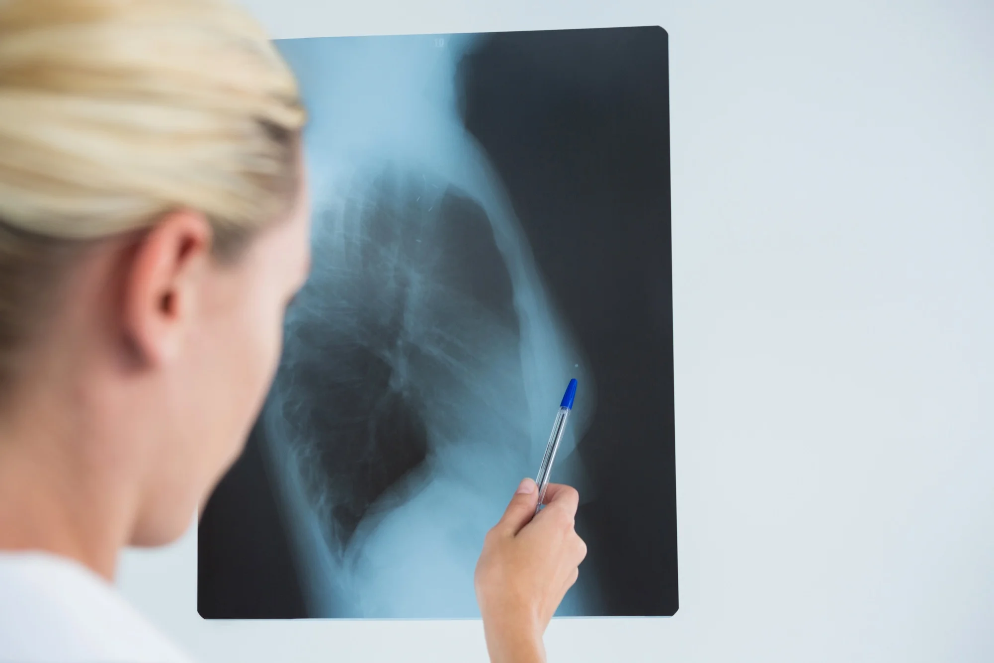 What Is CyberKnife S7 and Who Is It For?