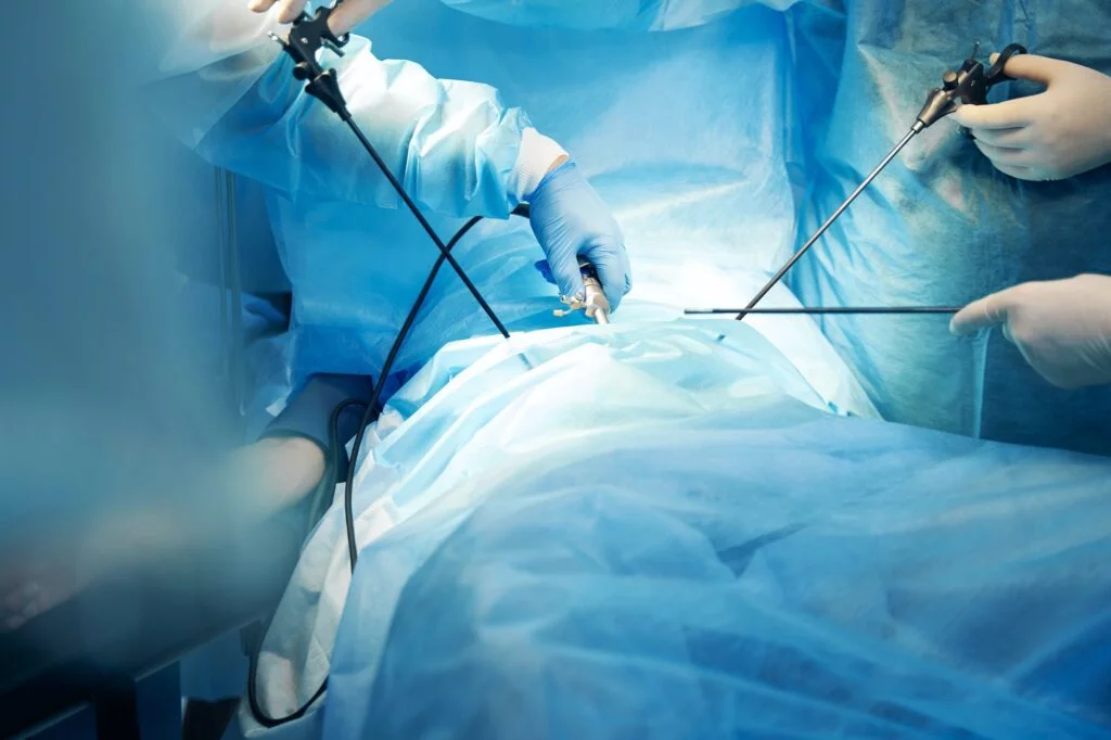 Laparoscopic Surgery