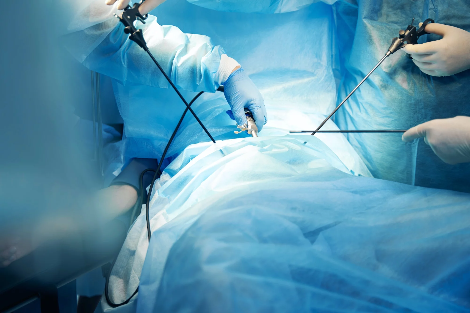 Laparoscopic Surgery