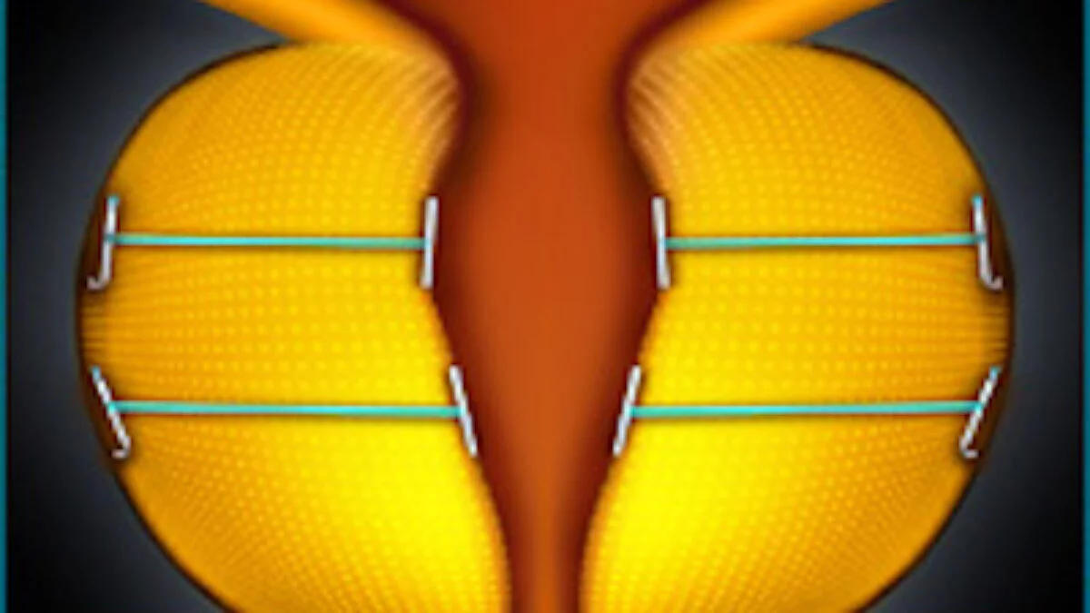 Urolift® | Unio Specialty Care